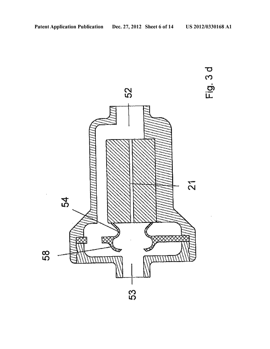 BLOOD VESSEL CATHETER AND INJECTION SYSTEM FOR CARRYING OUT A BLOOD     PRESSURE MEASUREMENT OF A PATIENT - diagram, schematic, and image 07