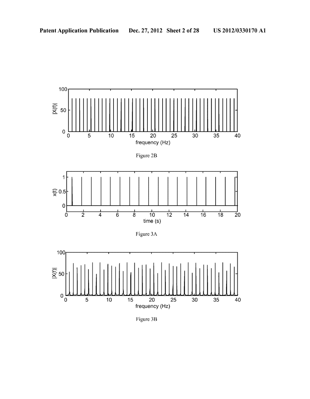 Methods, Systems and Devices for Detecting and Diagnosing Heart Diseases     and Disorders - diagram, schematic, and image 03