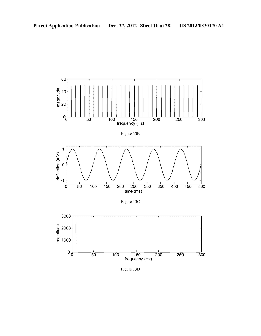 Methods, Systems and Devices for Detecting and Diagnosing Heart Diseases     and Disorders - diagram, schematic, and image 11