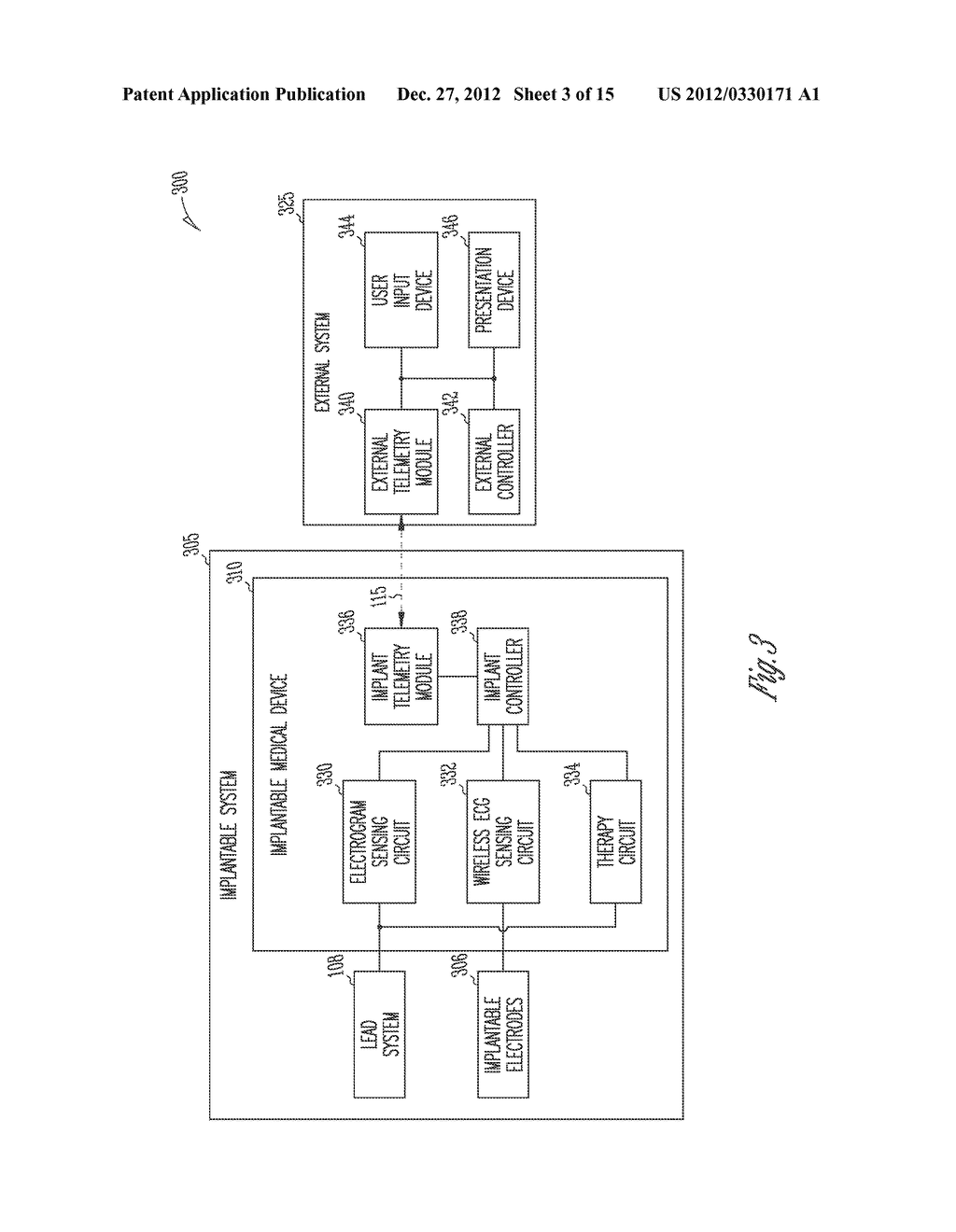 IMPLANTABLE MEDICAL DEVICE SENSING WIRELESS ECG AS SUBSTITUTE FOR     INTRACARDIAC ELECTROGRAM - diagram, schematic, and image 04