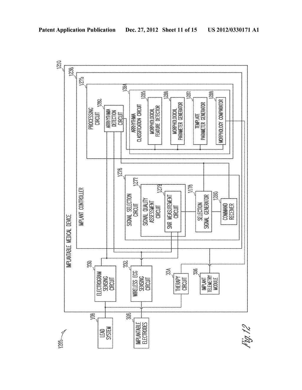 IMPLANTABLE MEDICAL DEVICE SENSING WIRELESS ECG AS SUBSTITUTE FOR     INTRACARDIAC ELECTROGRAM - diagram, schematic, and image 12