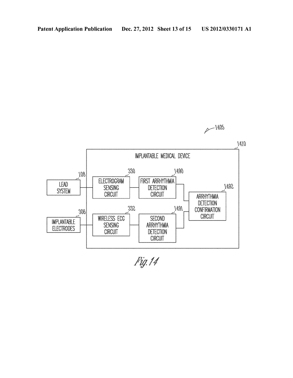 IMPLANTABLE MEDICAL DEVICE SENSING WIRELESS ECG AS SUBSTITUTE FOR     INTRACARDIAC ELECTROGRAM - diagram, schematic, and image 14