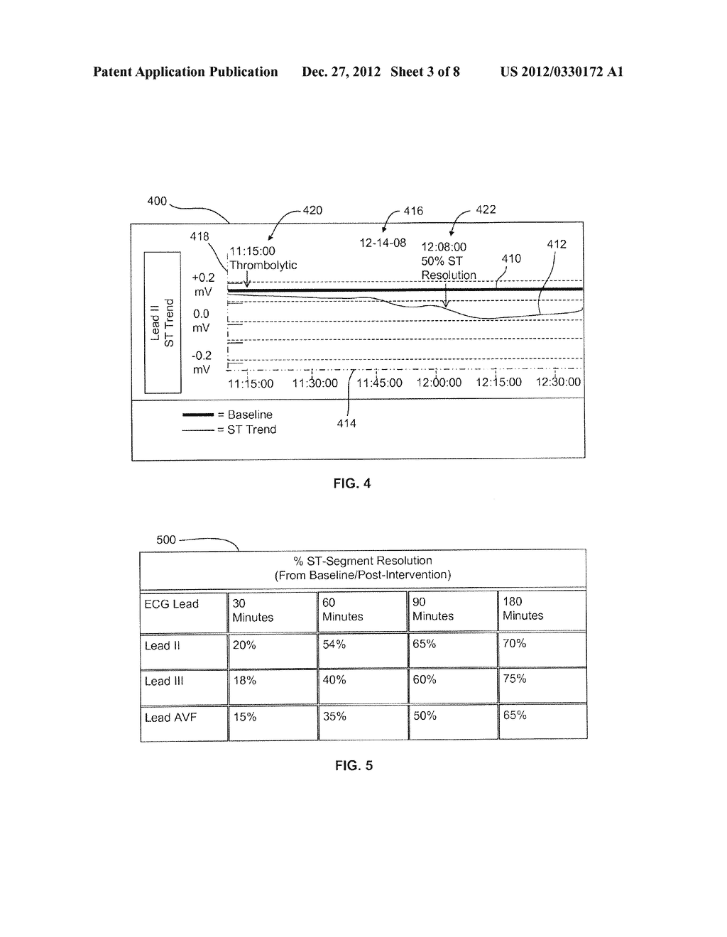 SYSTEMS AND METHODS FOR QUANIFYING AND PROVIDING INDICIA OF ST-SEGMENT     RESOLUTION IN AN ECG SIGNAL - diagram, schematic, and image 04