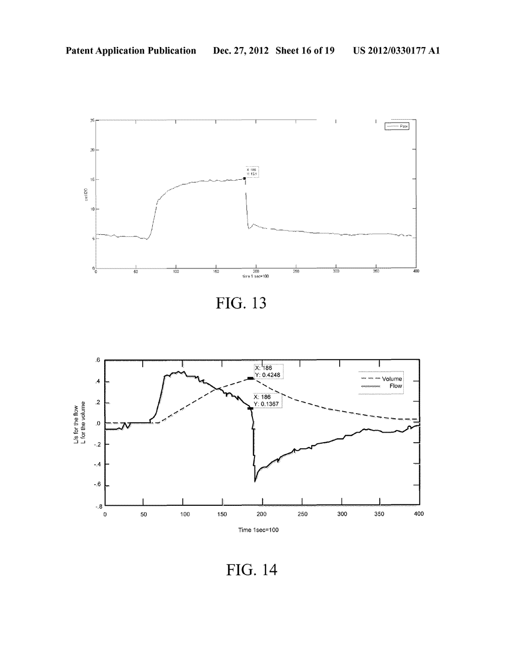 System and Method for Assessing Real Time Pulmonary Mechanics - diagram, schematic, and image 17