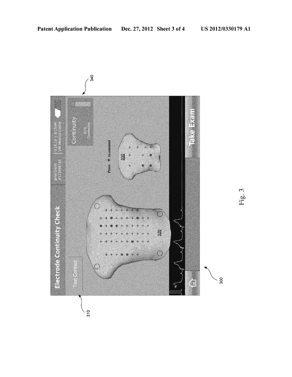 ELECTRODE CONTACT-QUALITY EVALUATION - diagram, schematic, and image 04