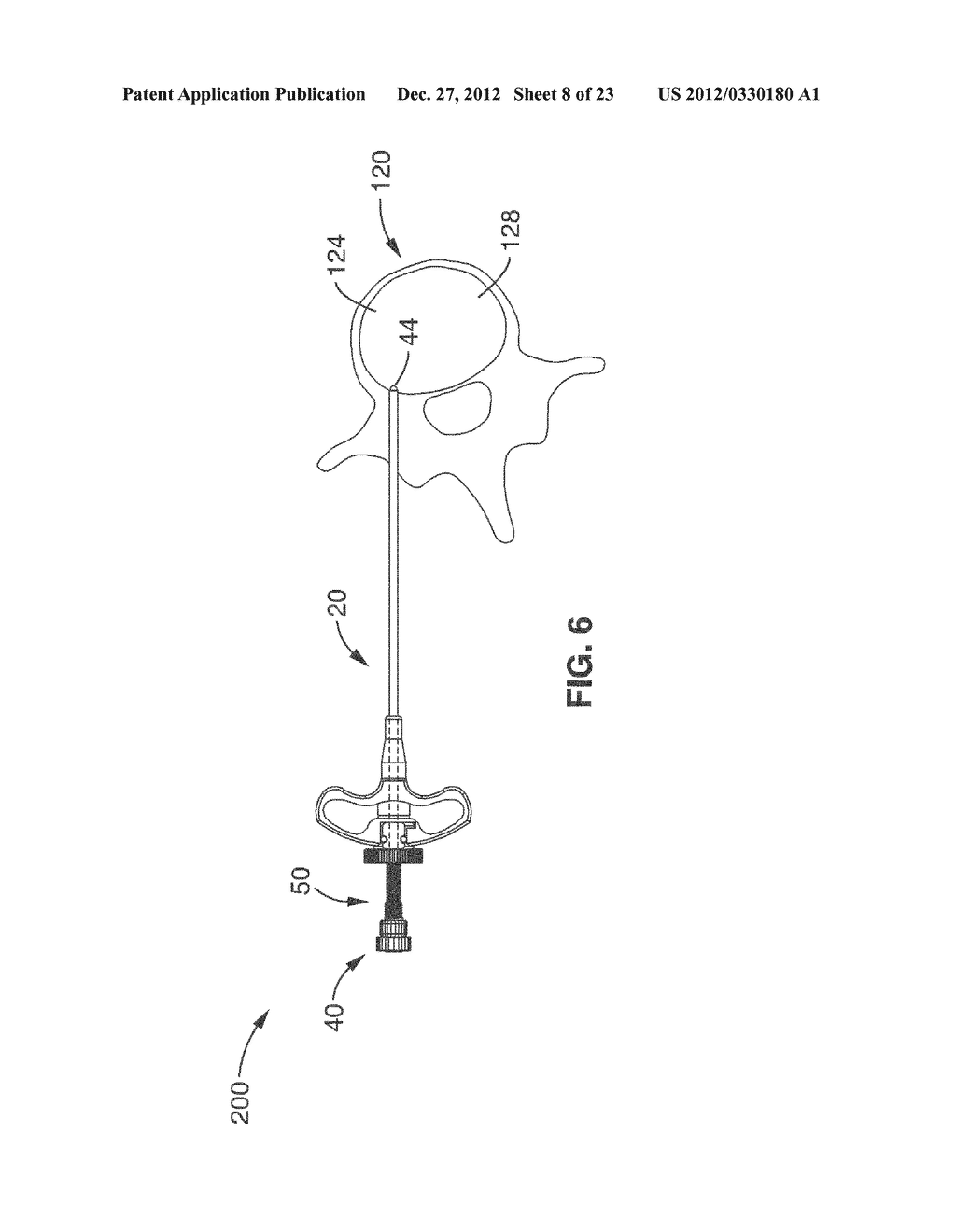 VERTEBRAL BONE CHANNELING SYSTEMS - diagram, schematic, and image 09