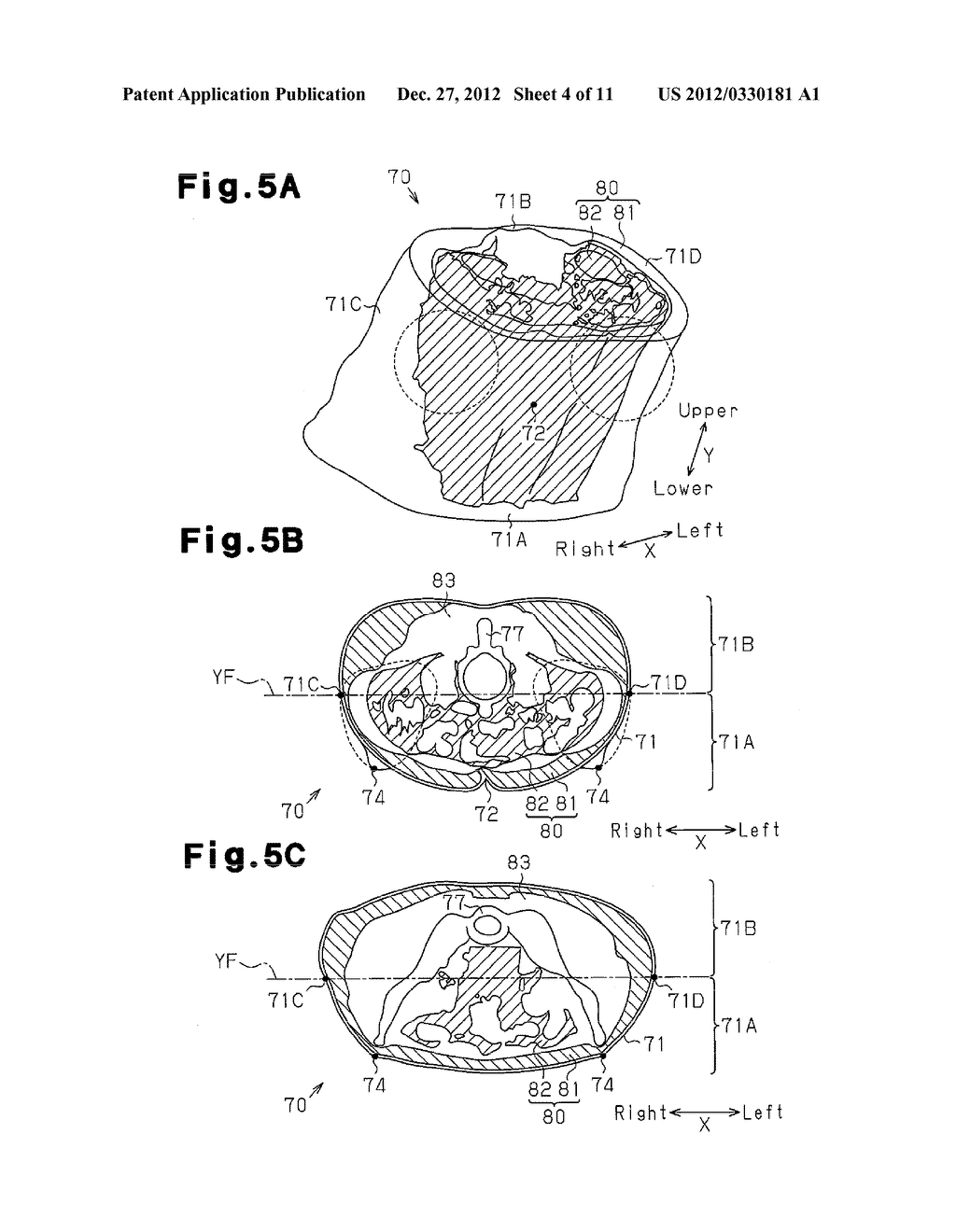 VISCERAL FAT MEASUREMENT DEVICE - diagram, schematic, and image 05