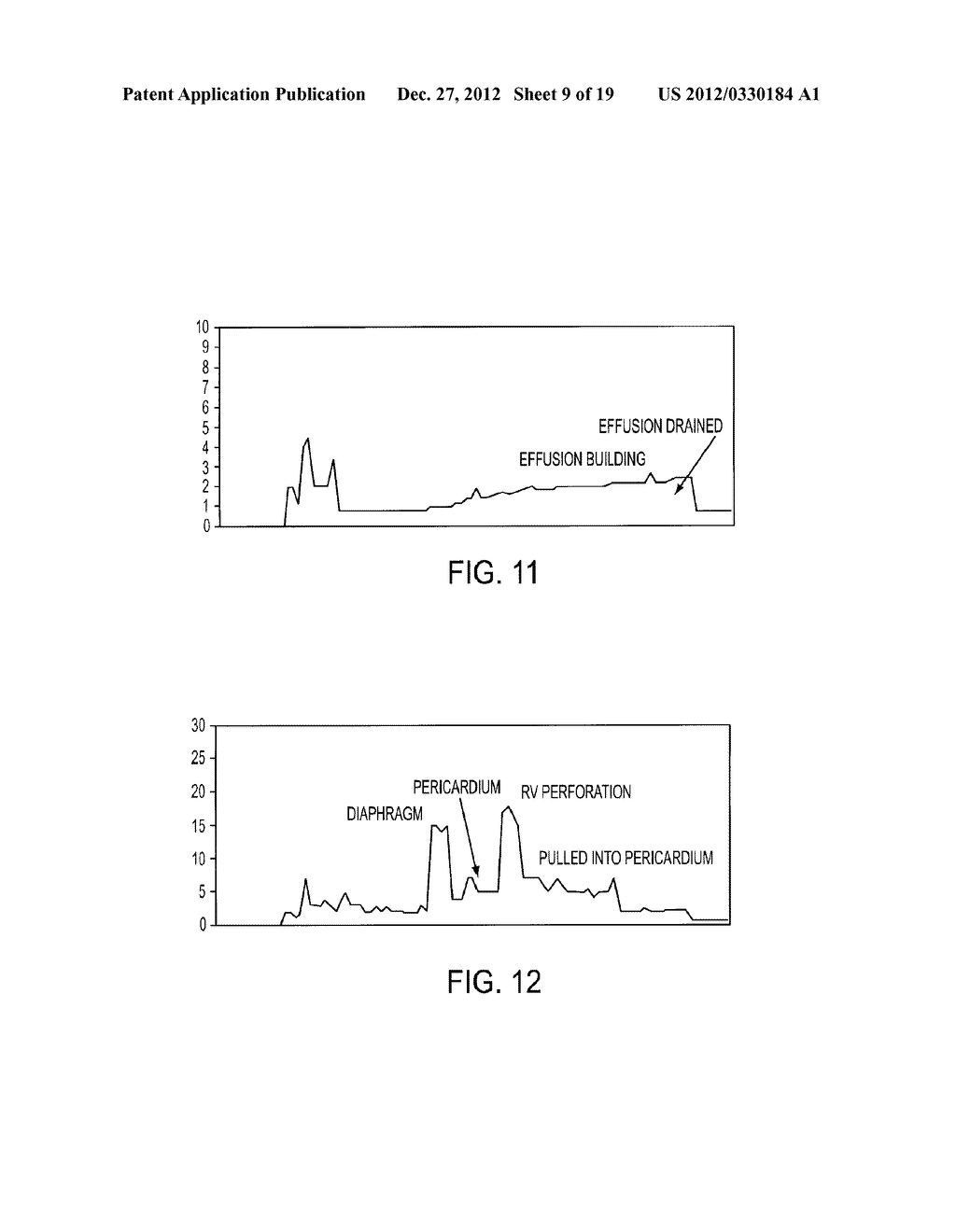 Access Needle Pressure Sensor Device and Method of Use - diagram, schematic, and image 10