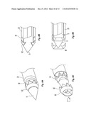 SINGLE-INSERTION, MULTIPLE SAMPLING BIOPSY DEVICE USABLE WITH VARIOUS     TRANSPORT SYSTEMS AND INTEGRATED MARKERS diagram and image