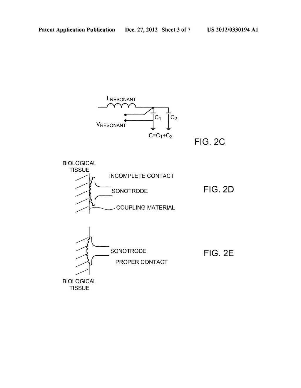 APPARATUS AND METHOD FOR TREATING TISSUE WITH ULTRASOUND - diagram, schematic, and image 04