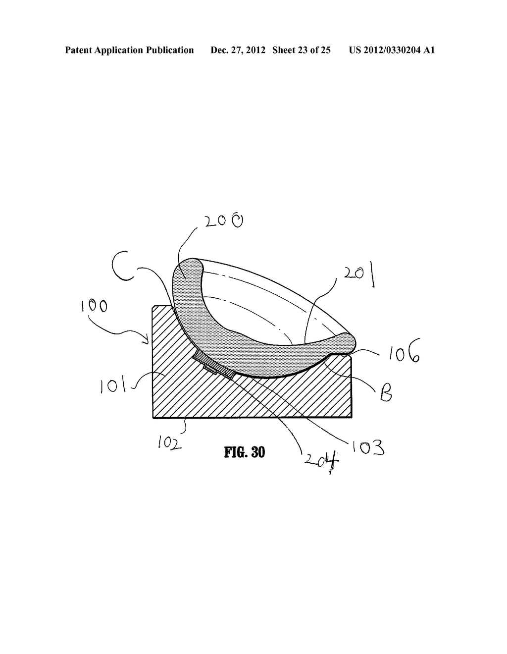 Therapeutic Cushioning and Devices for Assisting Respiration of and     administering fluid to a patient - diagram, schematic, and image 24