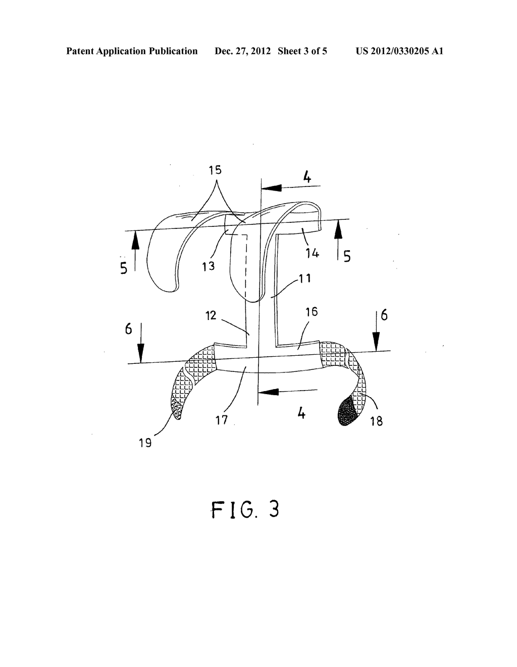 Posture correcting device - diagram, schematic, and image 04