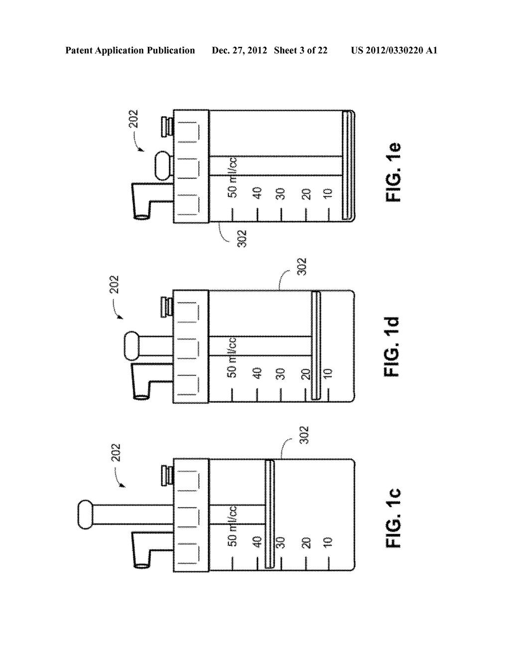 COLLECTION AND FILTRATION VIA SUCTION OF  BIOLOGICAL MATERIAL DURING     SURGICAL PROCEDURE - diagram, schematic, and image 04