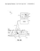 METHODS FOR TREATMENT OF HYPERHIDROSIS diagram and image