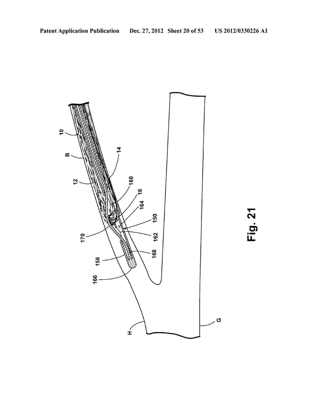 METHOD AND APPARATUS FOR STORAGE AND/OR INTRODUCTION OF ANATOMICAL IMPLANT - diagram, schematic, and image 21