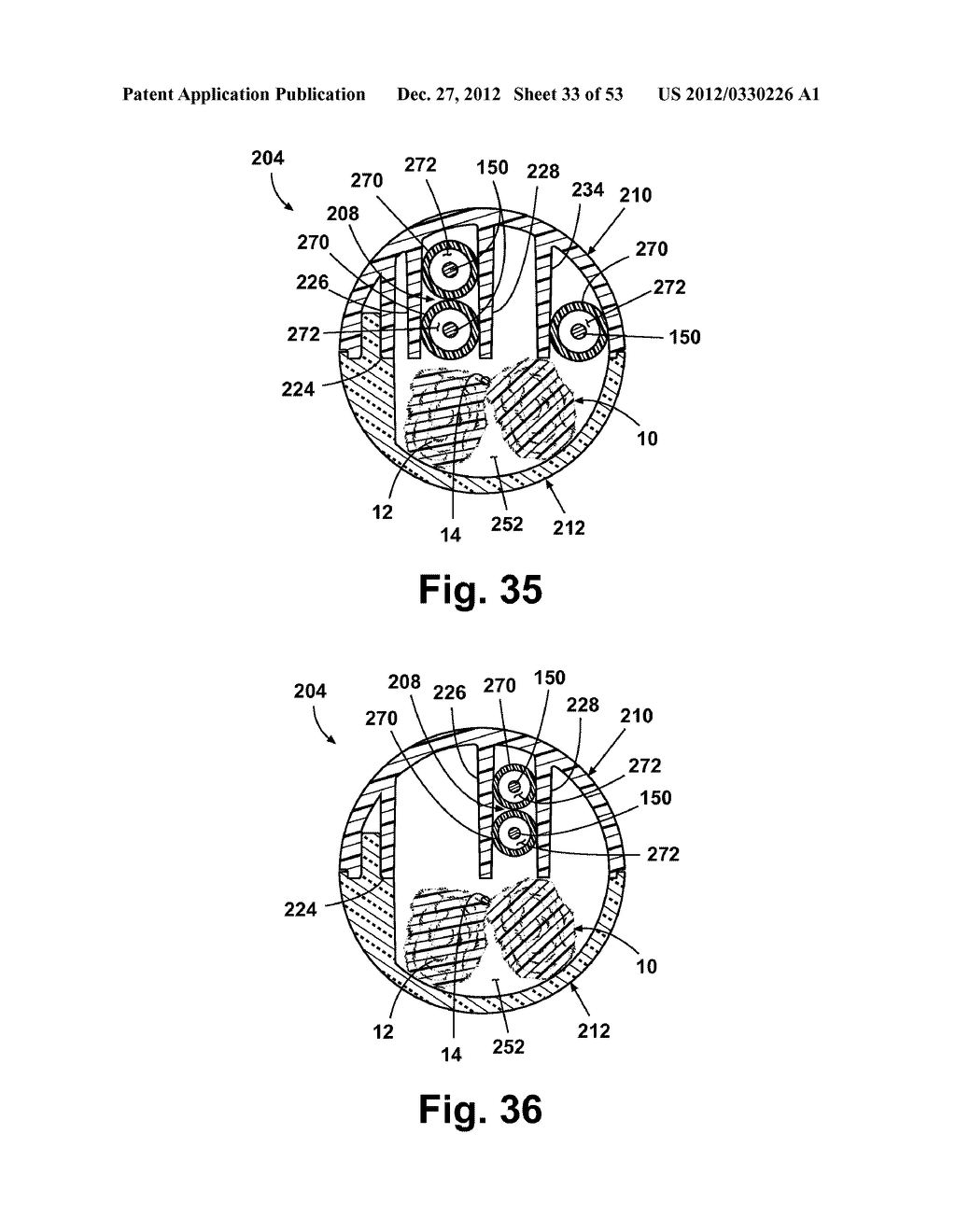 METHOD AND APPARATUS FOR STORAGE AND/OR INTRODUCTION OF ANATOMICAL IMPLANT - diagram, schematic, and image 34