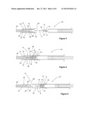 Medical Needle Cover Arrangement diagram and image