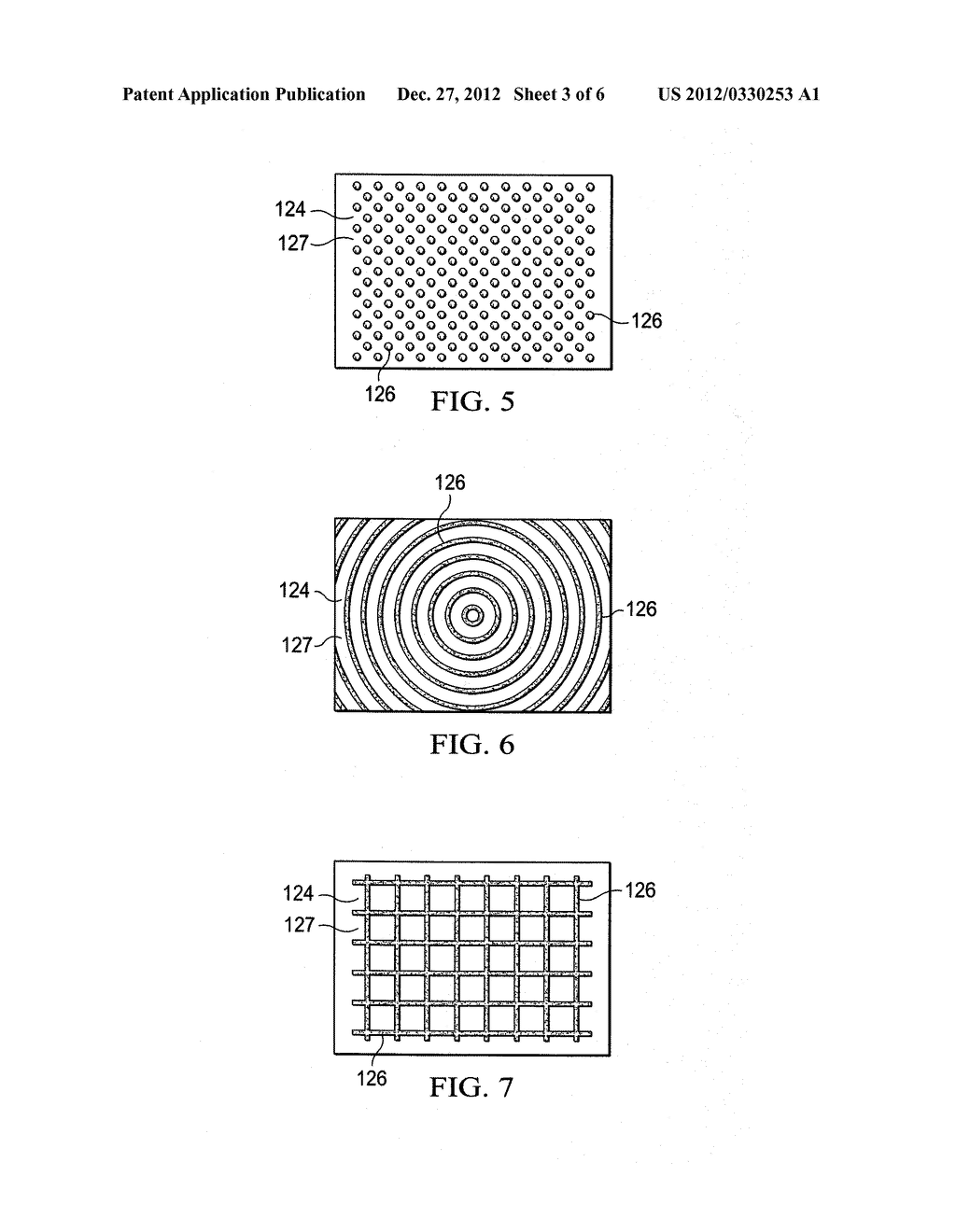 REDUCED-PRESSURE DRESSINGS EMPLOYING TISSUE-FIXATION ELEMENTS - diagram, schematic, and image 04