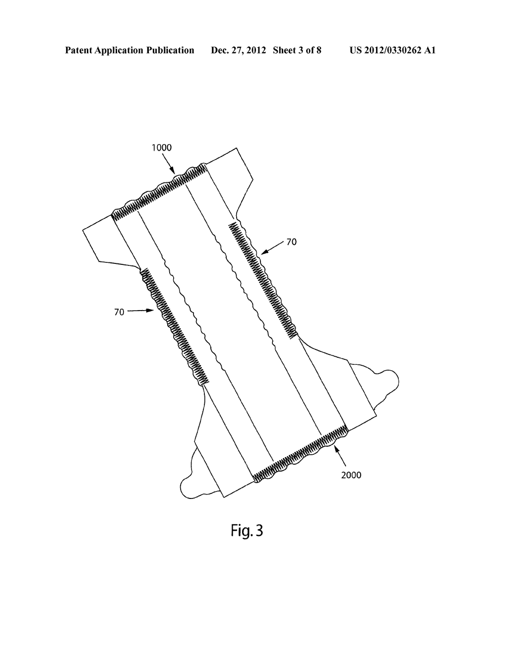 Absorbent Article With Waistband Having Contraction - diagram, schematic, and image 04