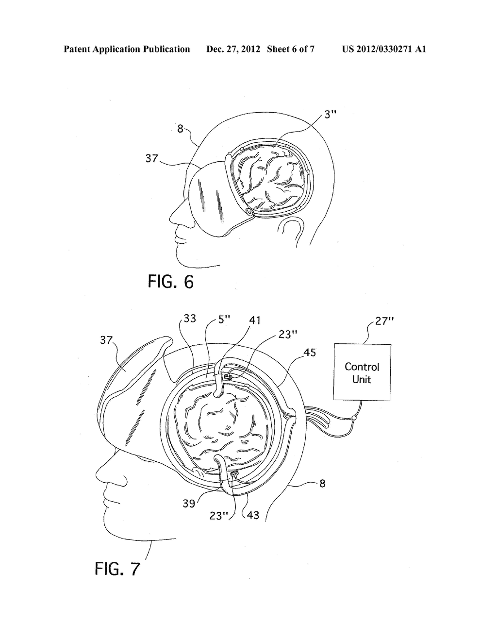 Method and Apparatus for the Containment of a Surgical Site - diagram, schematic, and image 07