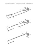 TISSUE EXTRACTION DEVICES AND METHODS diagram and image