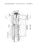 TISSUE EXTRACTION DEVICES AND METHODS diagram and image