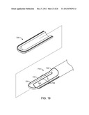 TISSUE EXTRACTION DEVICES AND METHODS diagram and image