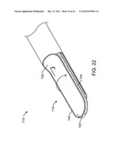 TISSUE EXTRACTION DEVICES AND METHODS diagram and image