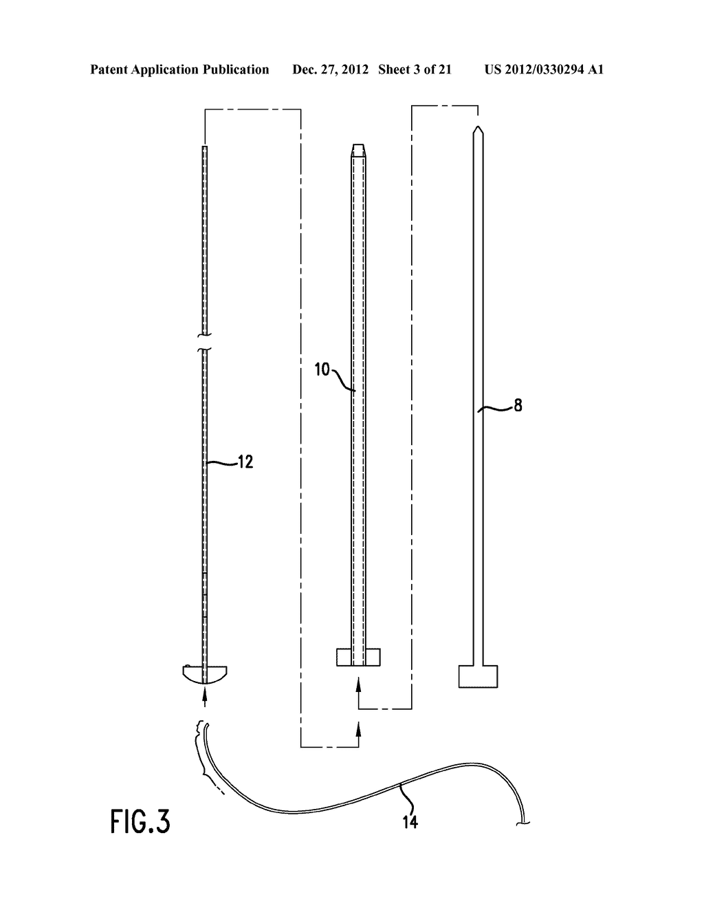 METHOD FOR TREATMENT OR EVACUATION OF INTERVERTEBRAL DISC - diagram, schematic, and image 04