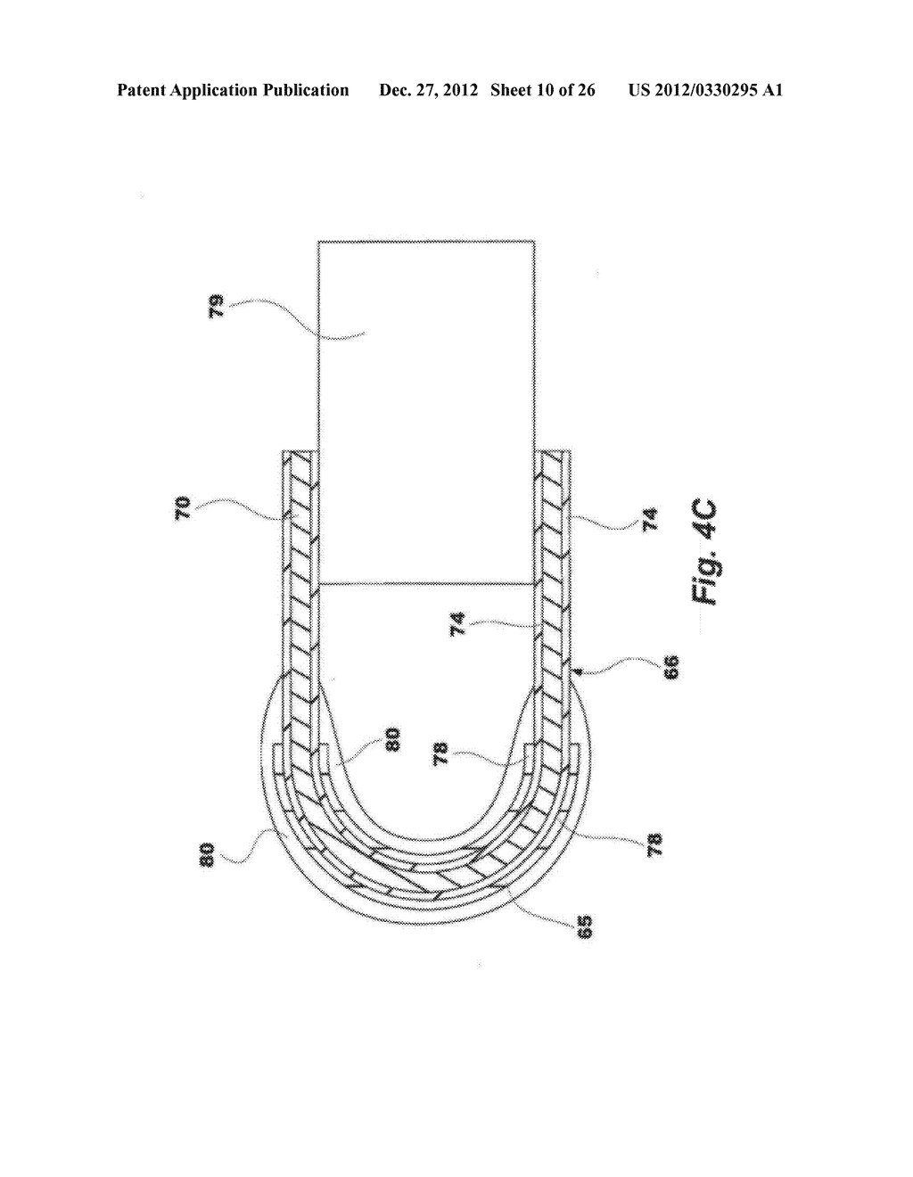 Thermal Resecting Loop - diagram, schematic, and image 11