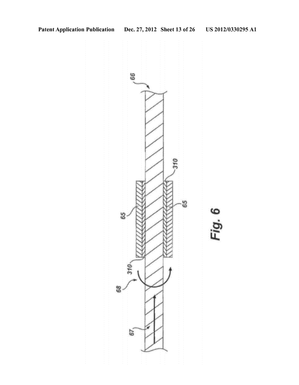 Thermal Resecting Loop - diagram, schematic, and image 14