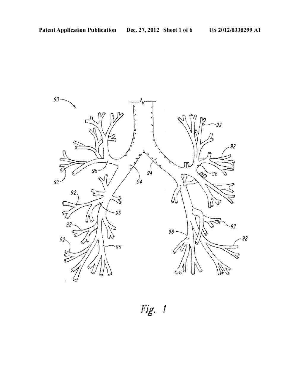 SYSTEMS AND METHODS FOR DELIVERING ENERGY TO PASSAGEWAYS IN A PATIENT - diagram, schematic, and image 02