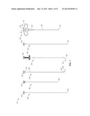 INTRAOSSEOUS NERVE DENERVATION METHODS diagram and image