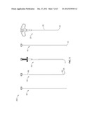 INTRAOSSEOUS NERVE DENERVATION METHODS diagram and image