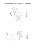 INTRAOSSEOUS NERVE DENERVATION METHODS diagram and image