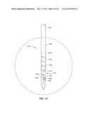 INTRAOSSEOUS NERVE DENERVATION METHODS diagram and image