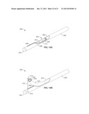 INTRAOSSEOUS NERVE DENERVATION METHODS diagram and image