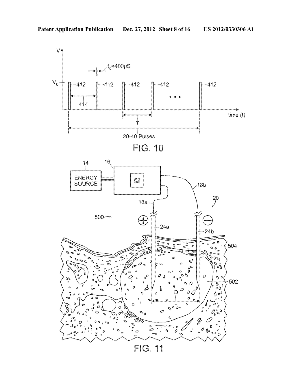 ELECTRICAL ABLATION DEVICES - diagram, schematic, and image 09