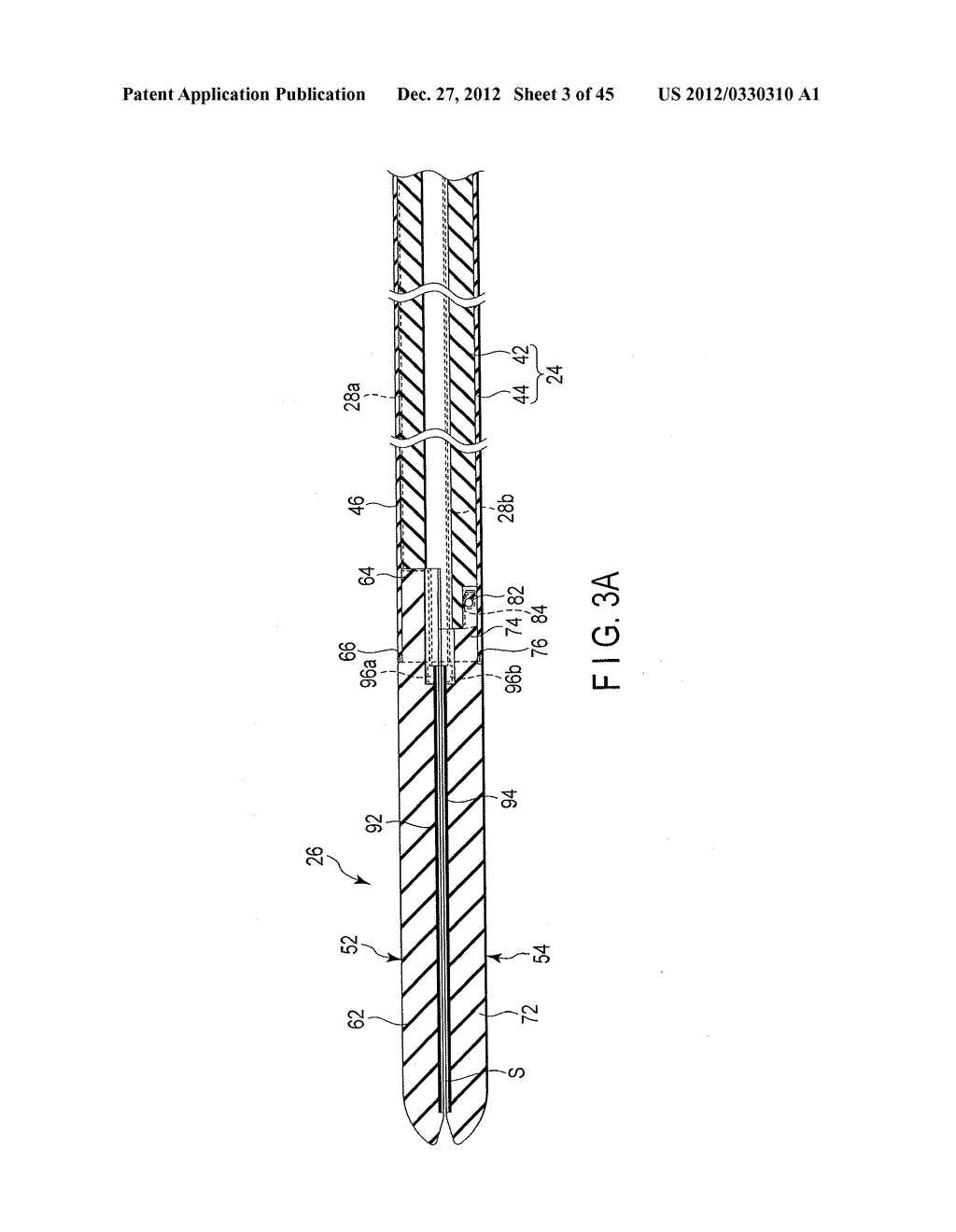 MEDICAL TREATMENT APPARATUS AND CONTROL METHOD OF MEDICAL TREATMENT DEVICE - diagram, schematic, and image 04