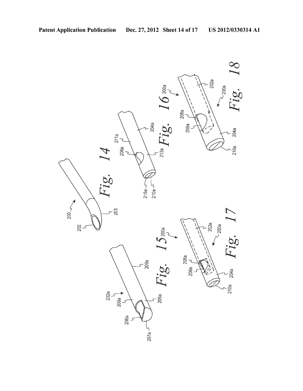 Devices And Methods For Treating Bone Tissue - diagram, schematic, and image 15