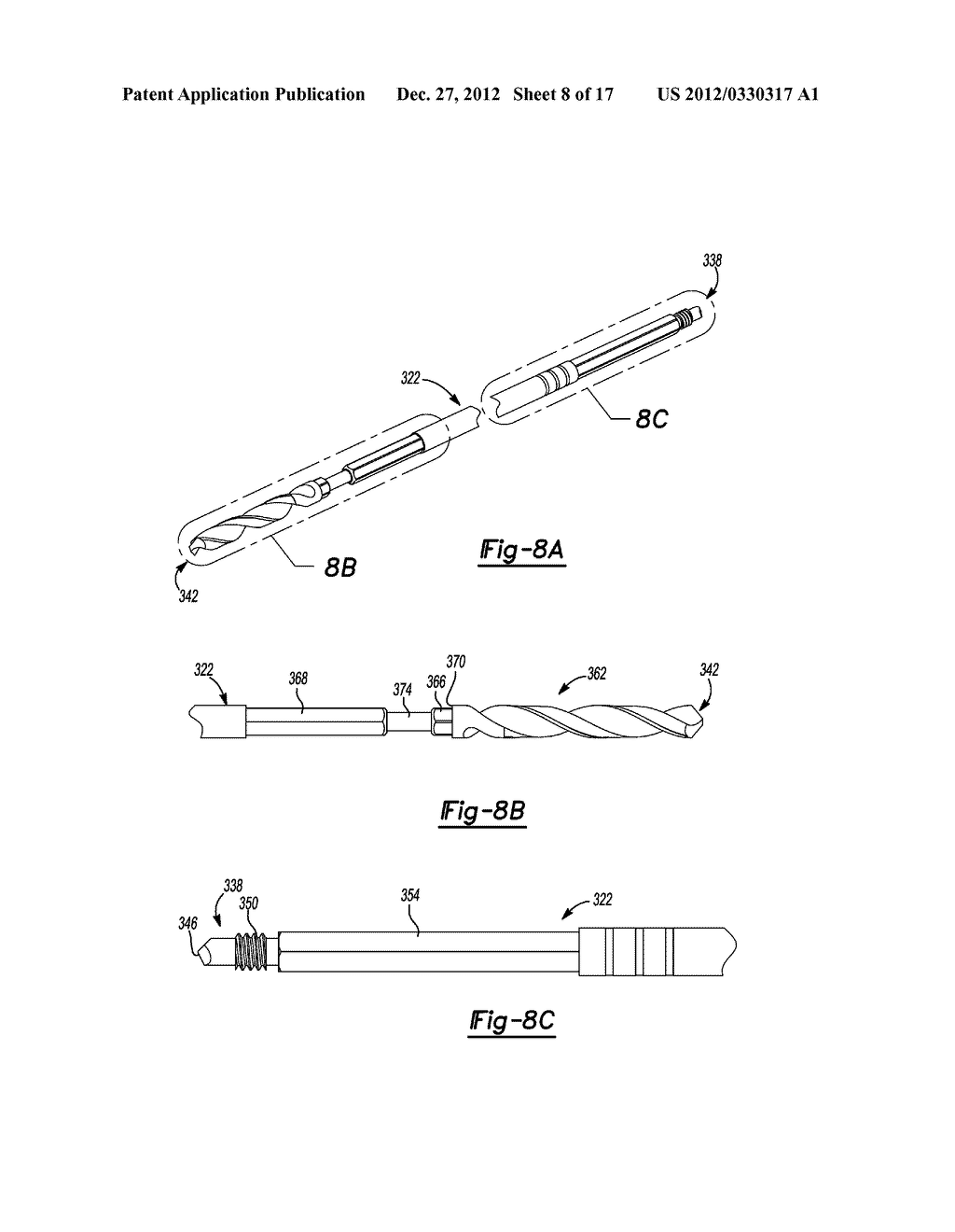 Method for Repairing Bone Defects - diagram, schematic, and image 09