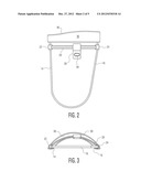 CUTTING GUIDE FOR REMOVAL OF CAM LESION diagram and image