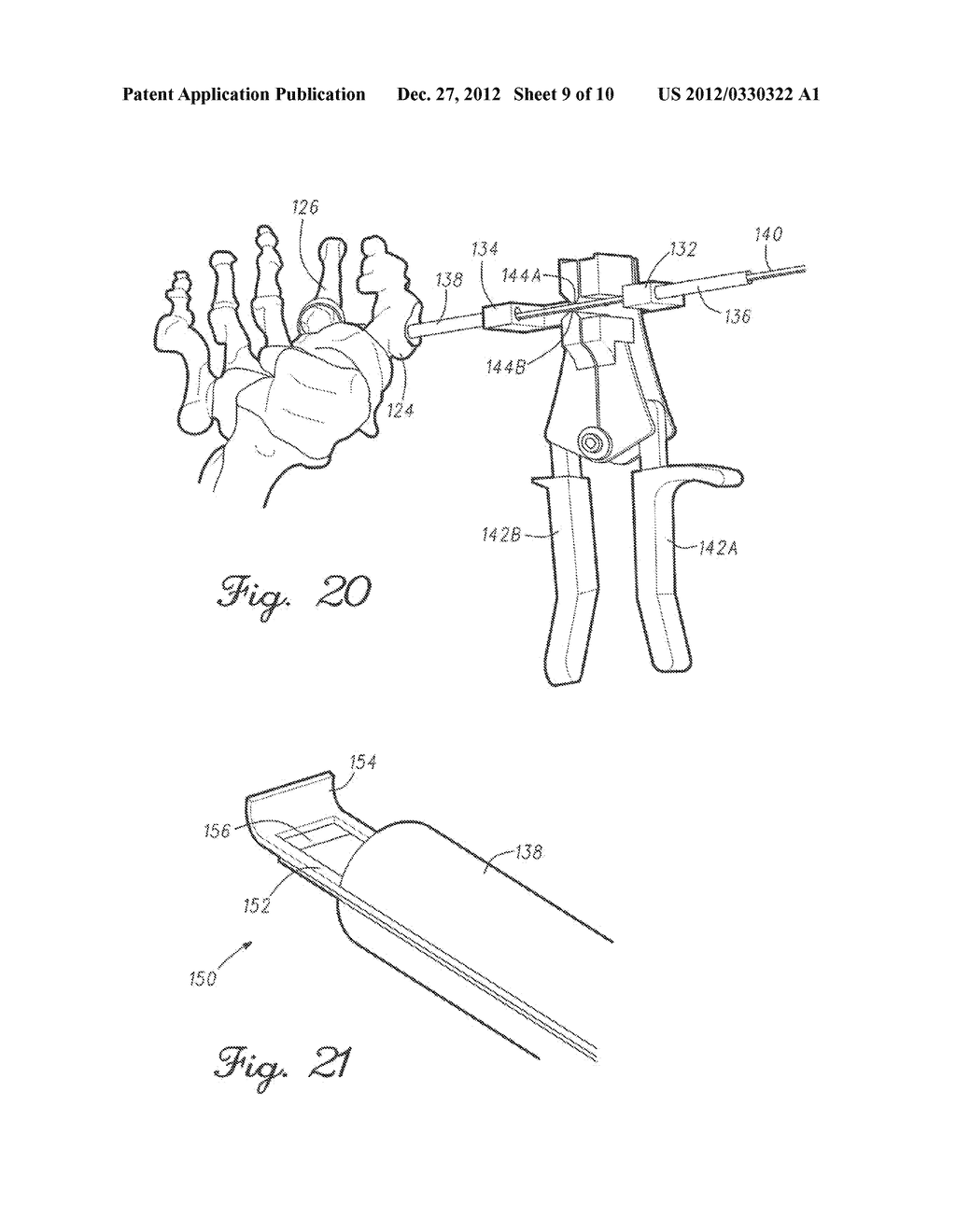 METHODS AND DEVICES FOR TREATING A STRUCTURAL BONE AND JOINT DEFORMITY - diagram, schematic, and image 10