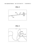 ACL RECONSTRUCTION TUNNEL GAUGE AND METHOD diagram and image