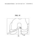 ACL RECONSTRUCTION TUNNEL GAUGE AND METHOD diagram and image