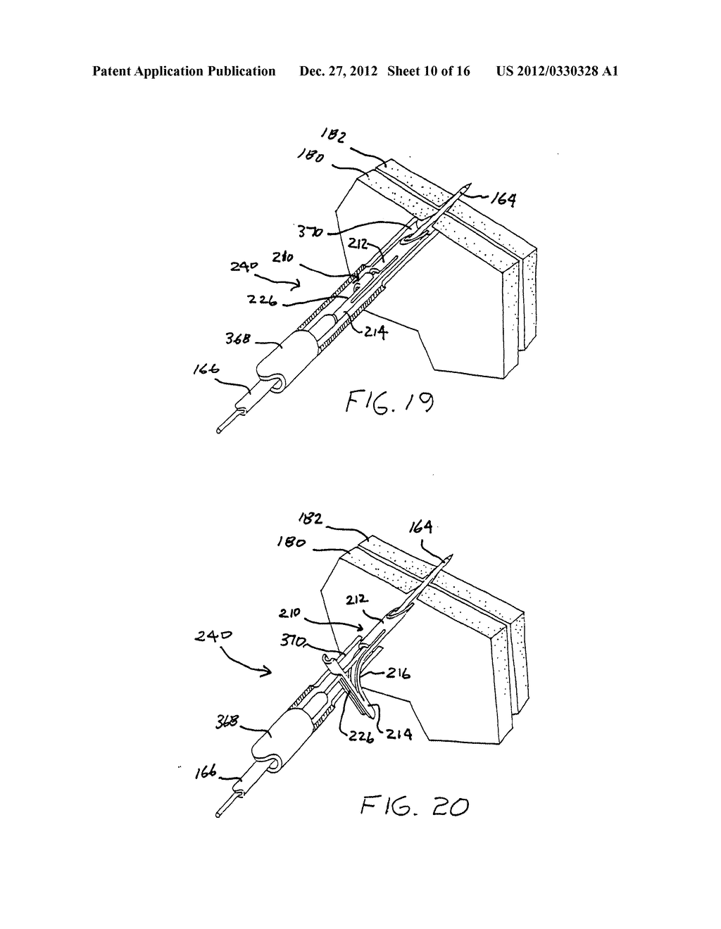 TISSUE FIXATION DEVICES AND A TRANSORAL ENDOSCOPIC GASTROESOPHAGEAL FLAP     VALVE RESTORATION DEVICE AND ASSEMBLY USING SAME - diagram, schematic, and image 11