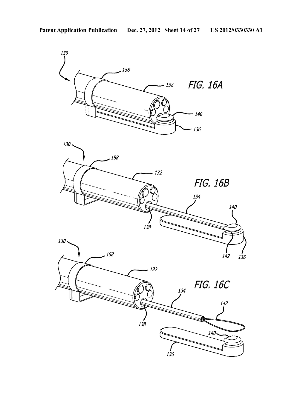 Incisionless Gastric Bypass Method And Devices - diagram, schematic, and image 15