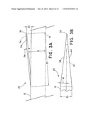 METHOD FOR OPEN SURGICAL PLACEMENT diagram and image