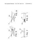 METHOD FOR OPEN SURGICAL PLACEMENT diagram and image