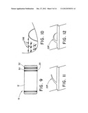 METHOD FOR OPEN SURGICAL PLACEMENT diagram and image